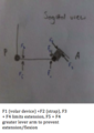 3 force diagram sagittal.tiff