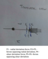 3 force Transverse.tiff